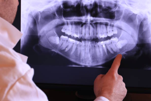 Best Emergency Dental Care for Sports Injuries in Alexandria, VA