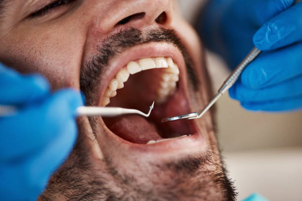 Best Emergency Care for Gum Disease in Alexandria, VA