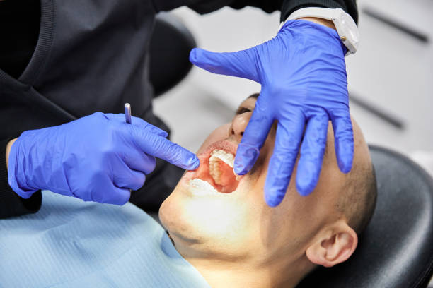 Best Broken or Chipped Tooth Repair in Alexandria, VA